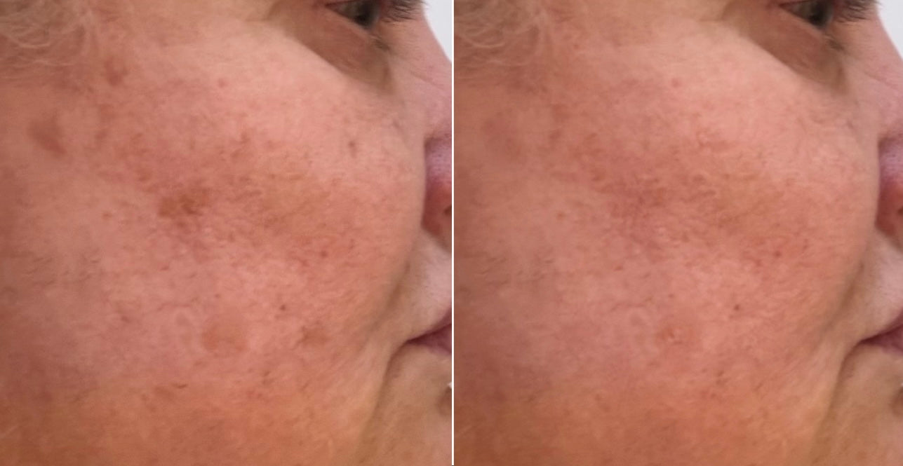 The Hydrating Retinol